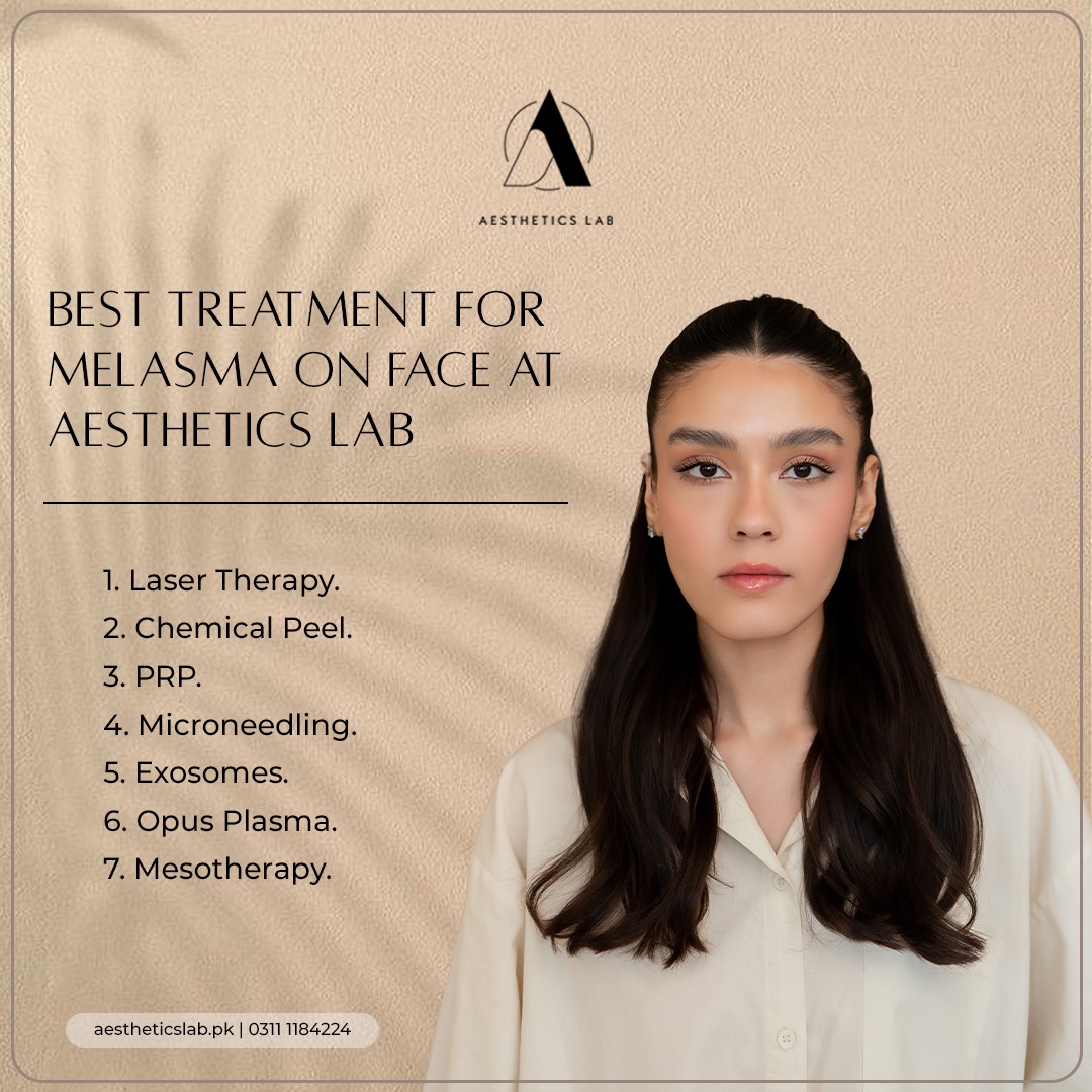 best treatment for melasma