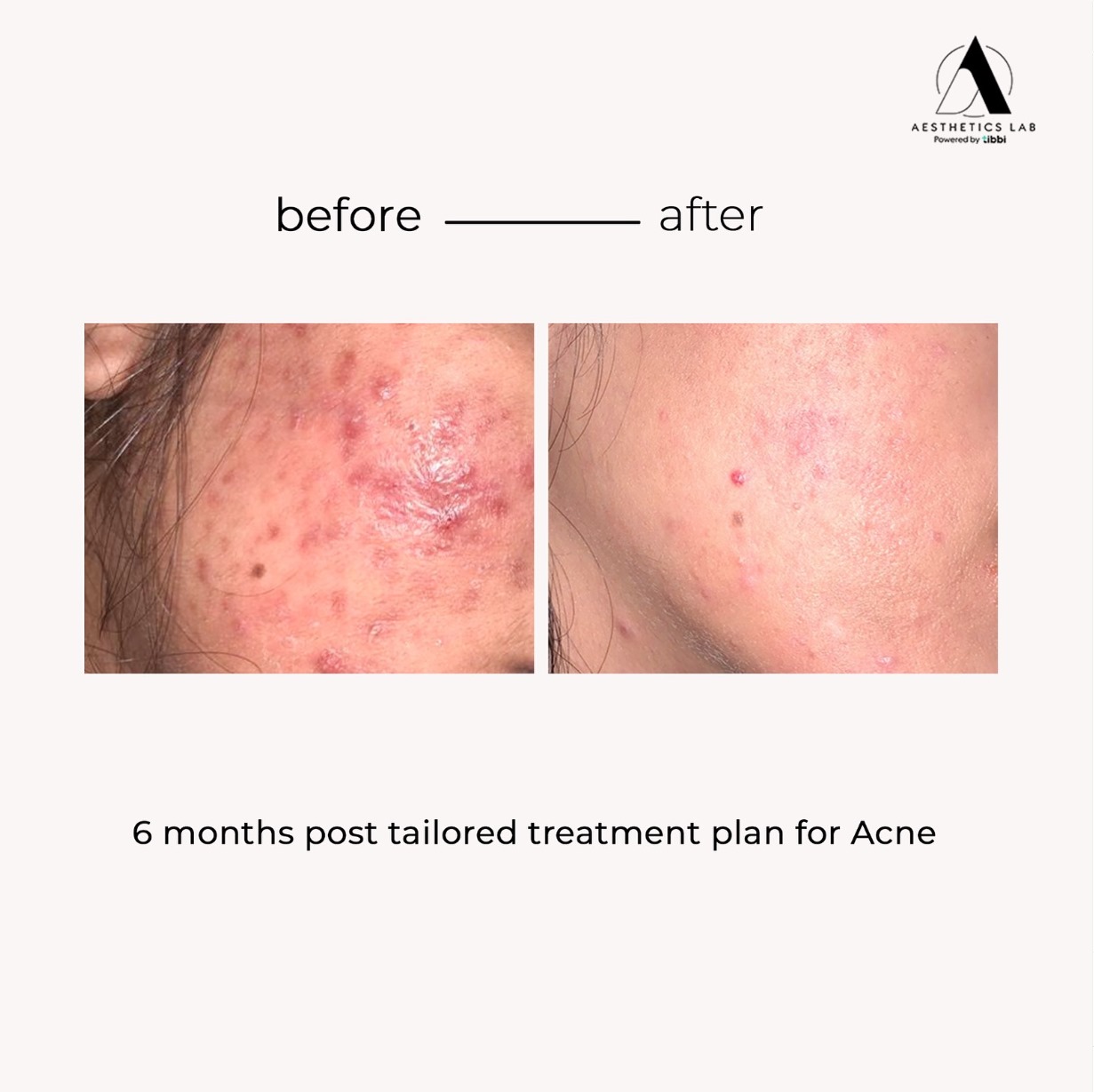 Before Treatment