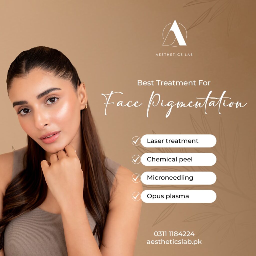 best treatment for face pigmentation 
