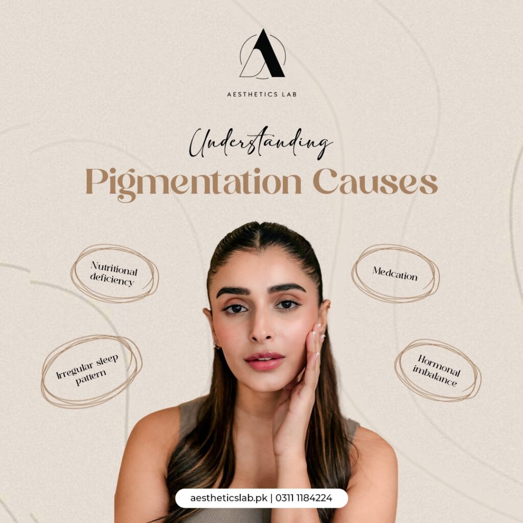 causes of pigmentation 