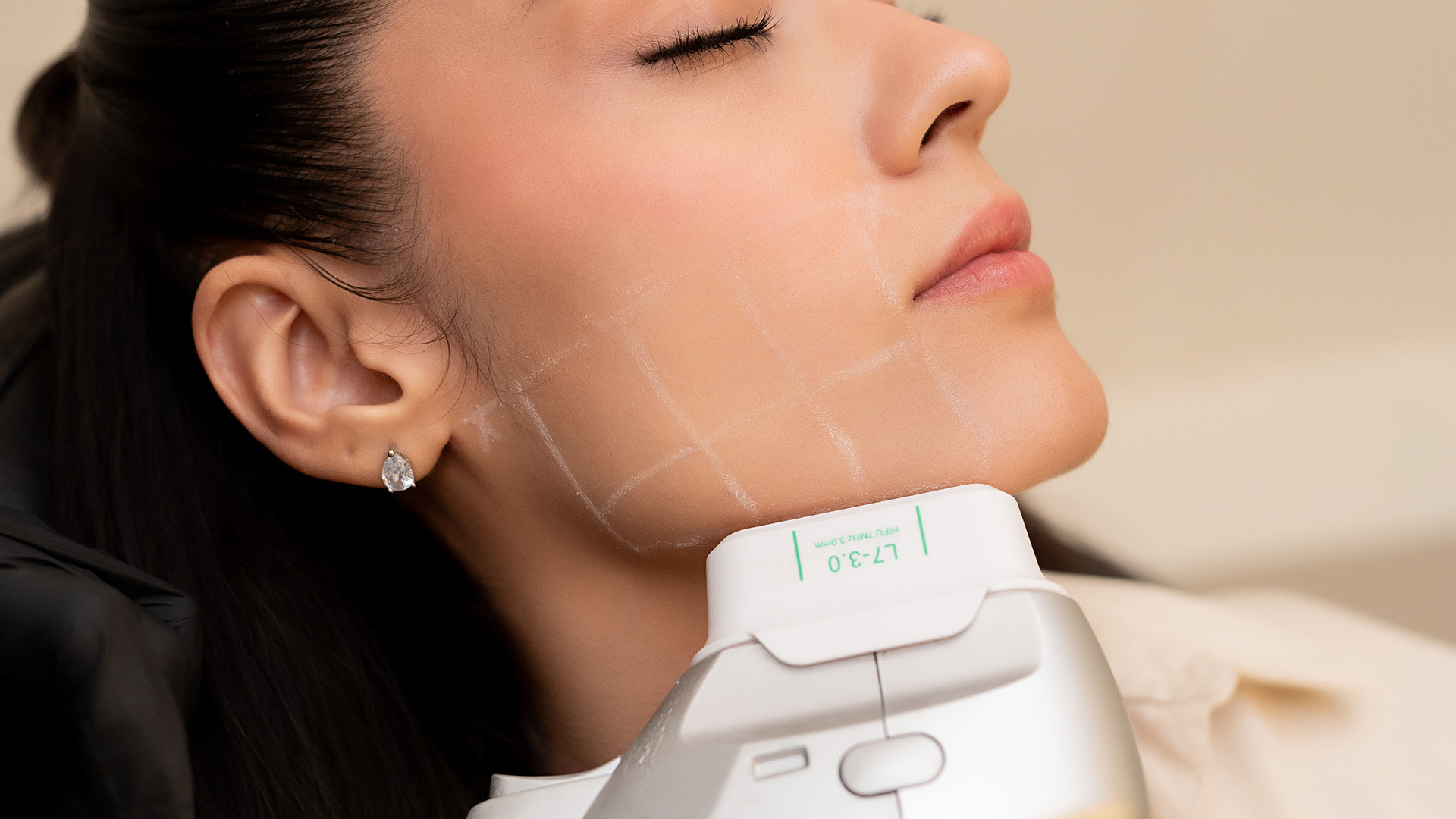 HydraFacial Treatment Image